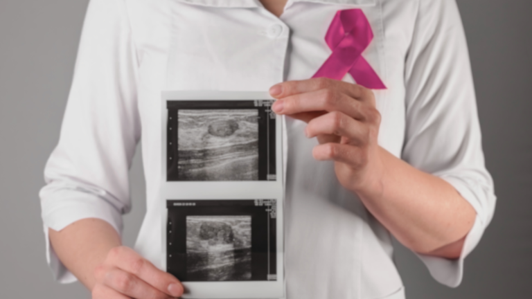 Mobile Breast Screening for Western Suburbs